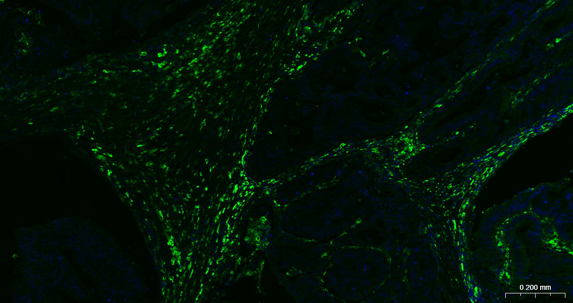 CD163 Rabbit pAb(bs-2527R)-50u