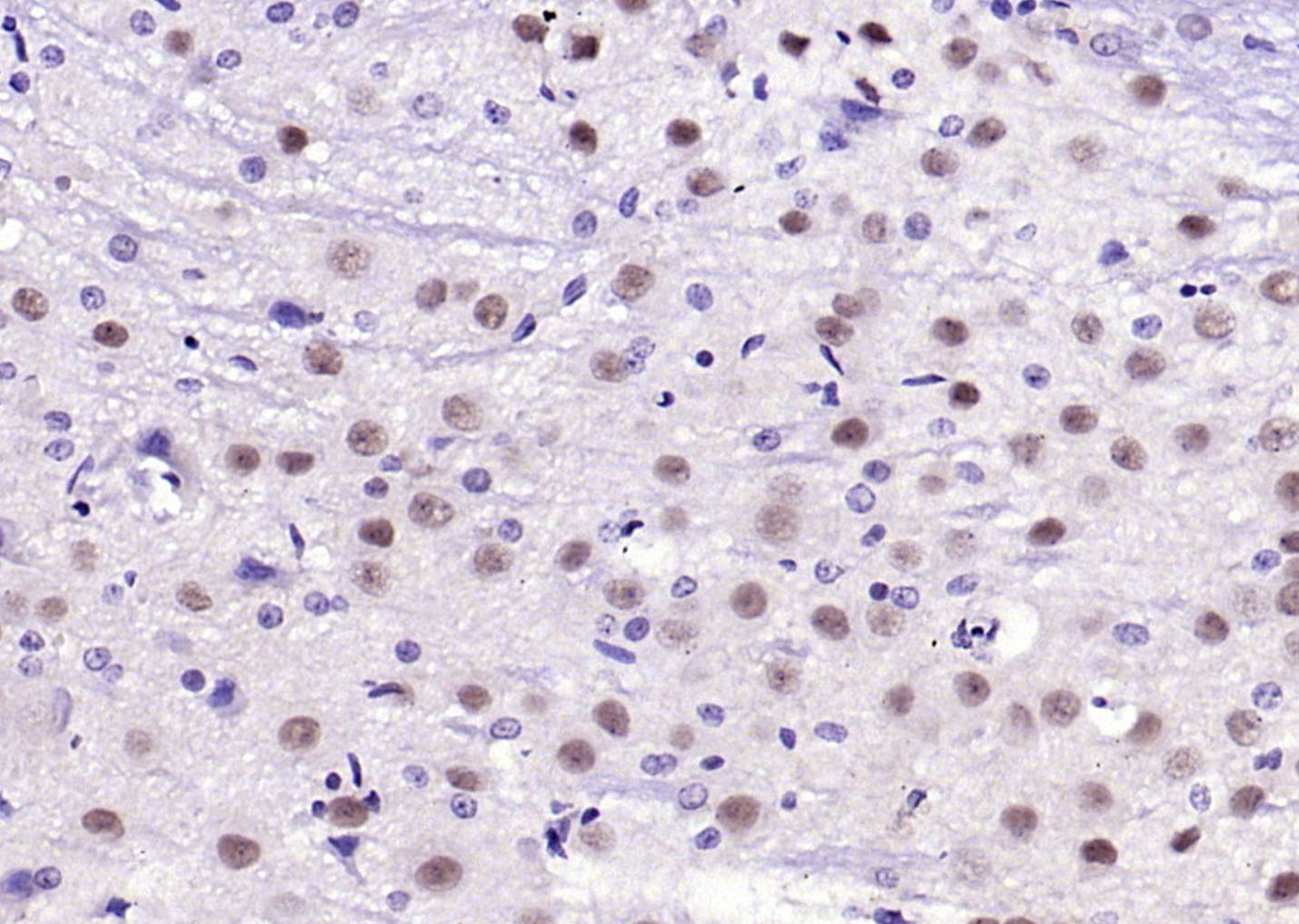 Nova1 Rabbit pAb(bs-11324R)-50