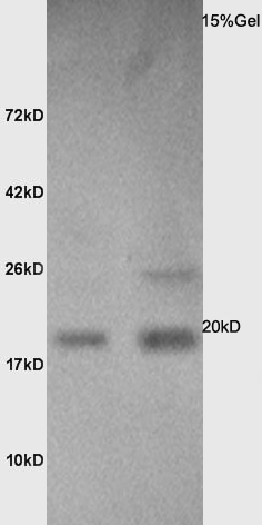 Calmodulin 1/2/3 Rabbit pAb(bs