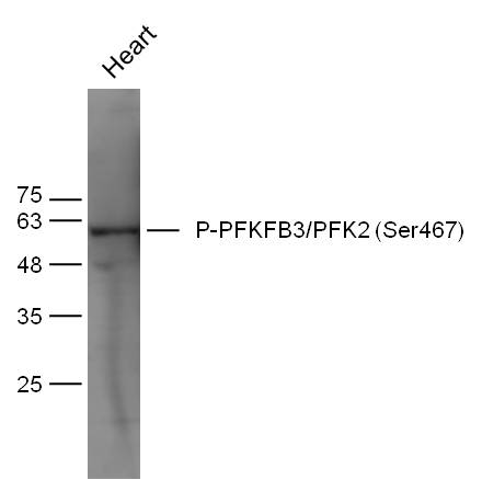 phospho-PFKFB3/PFK2 (Ser467) R