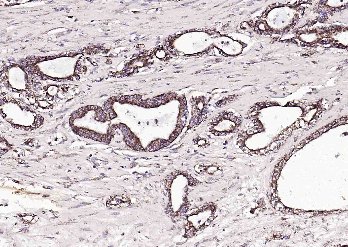 FAM83H Rabbit pAb(bs-16018R)-5