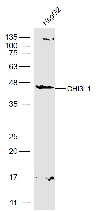 CHI3L1 Rabbit pAb(bs-10215R)-5