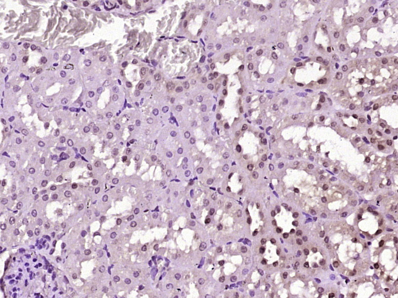 GABPA Rabbit pAb(bs-13261R)-50