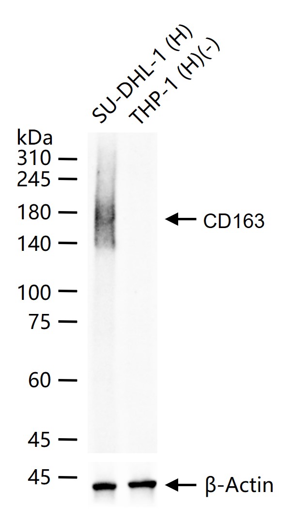 CD163 Rabbit pAb(bs-2527R)-50u