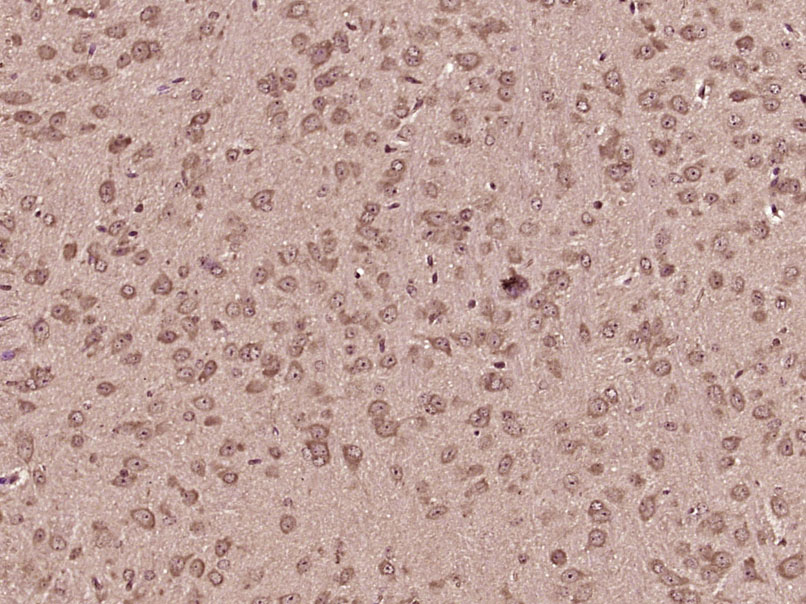 PISD Rabbit pAb(bs-8866R)-50ul