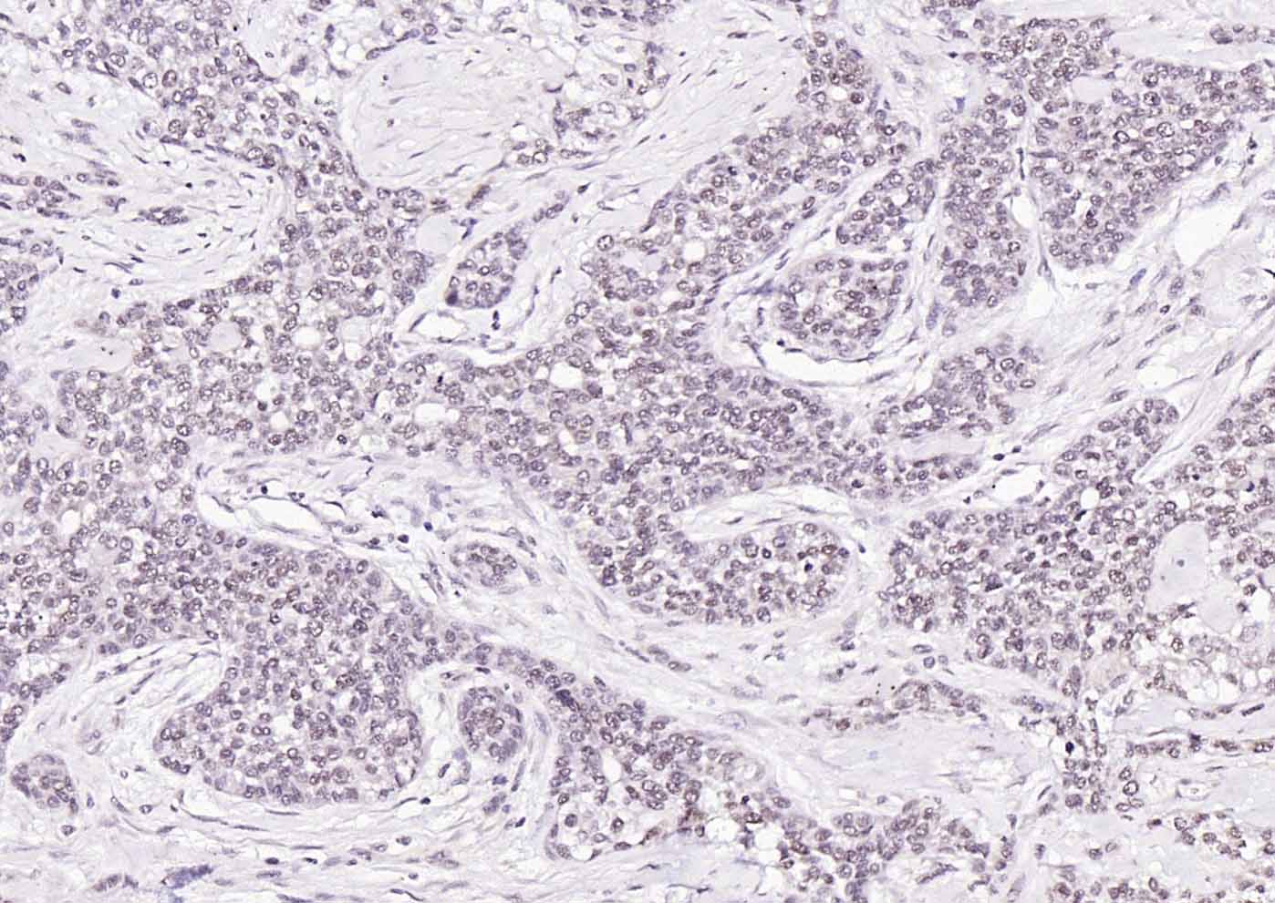 HSF1 Rabbit pAb(bs-3757R)-50ul