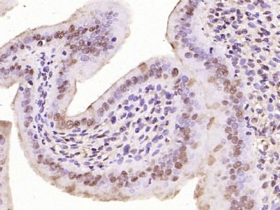 phospho C-Myc (Thr58 / Ser62) 