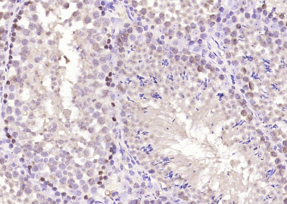 phospho-CREM (Ser271 + Ser274)