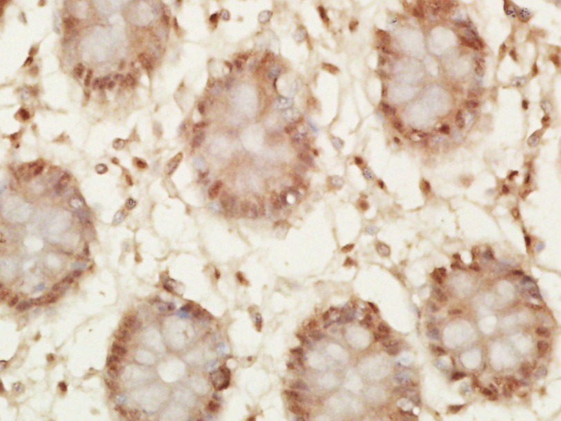 phospho-P53 (Thr55) Rabbit pAb