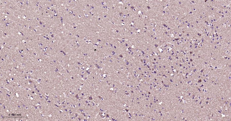 VDAC1 Recombinant Rabbit mAb, 