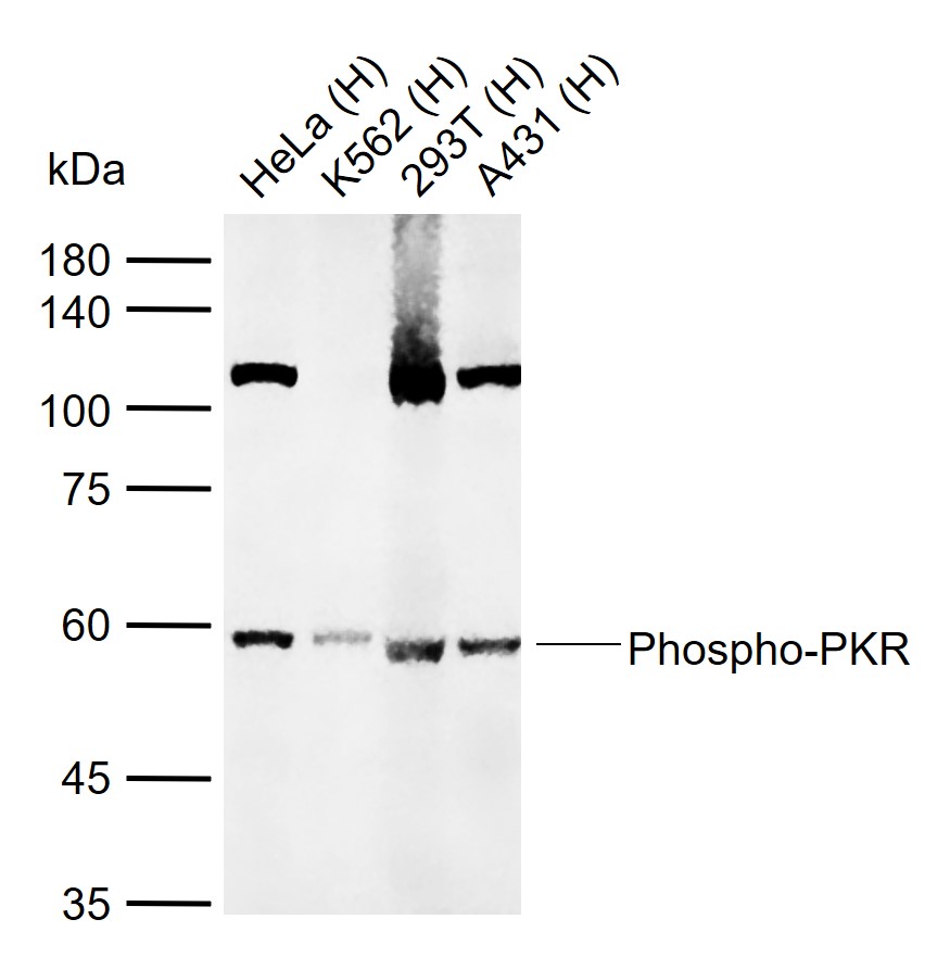 phospho-PKR (Thr446 + Thr451)