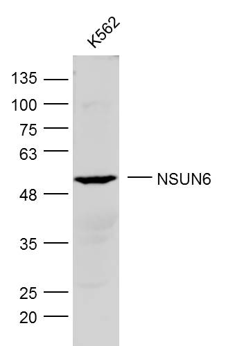 NSUN6 Rabbit pAb(bs-19484R)-50