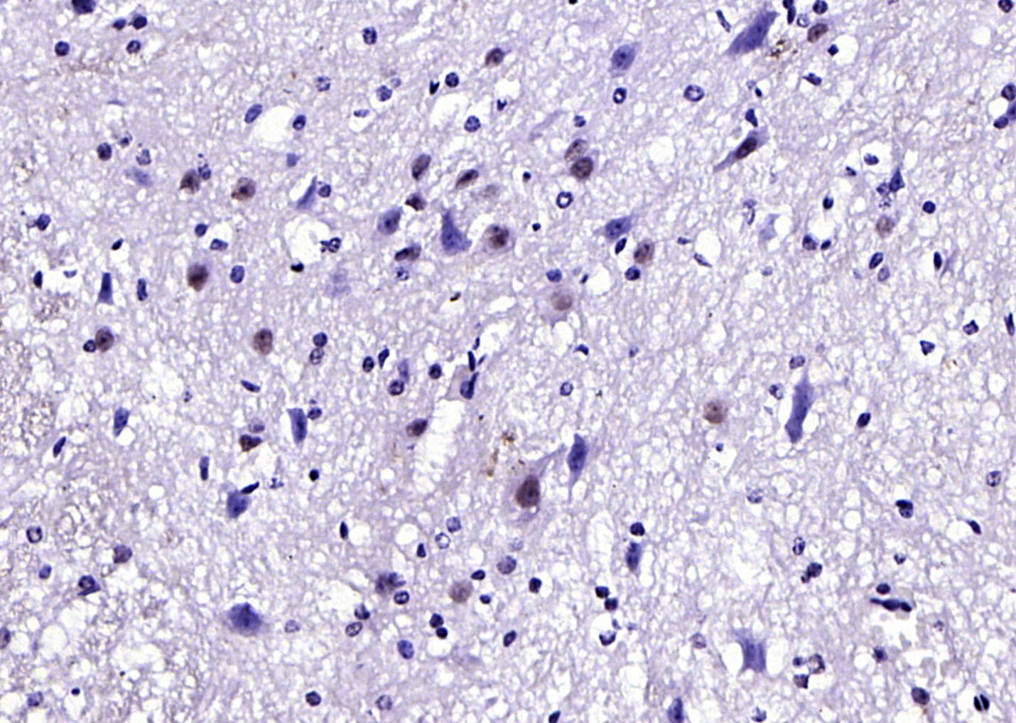 HOXA6 Rabbit pAb(bs-11294R)-50