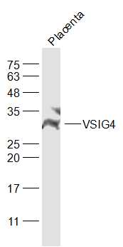 VSIG4 Rabbit pAb(bs-0479R)-50u