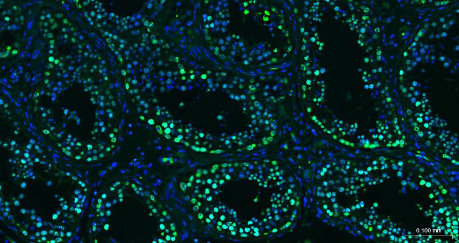 Histone H3(di methyl K27) Mous
