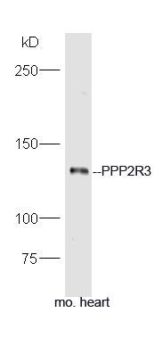 PPP2R3 Rabbit pAb(bs-5759R)-50