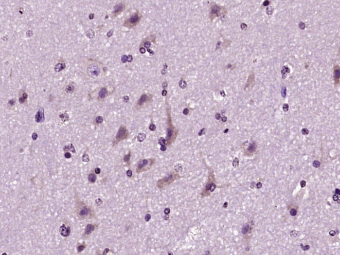 Phospholipase C beta 2 Rabbit 