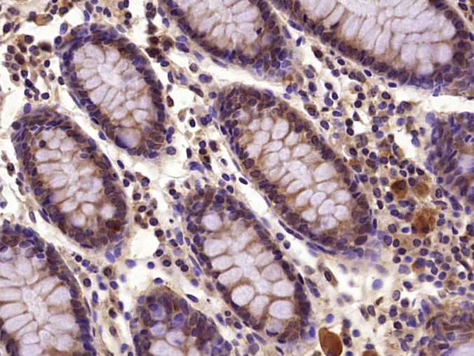 PIK3R2 Rabbit pAb(bs-4160R)-50