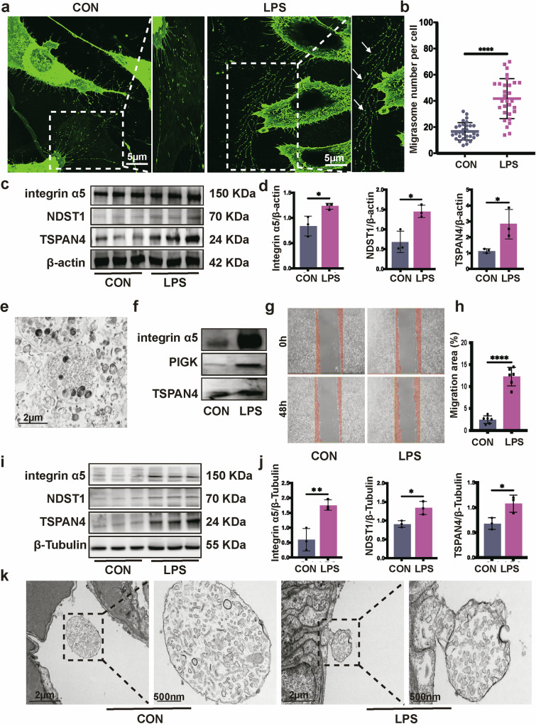 透射电镜检测 透射电镜检测