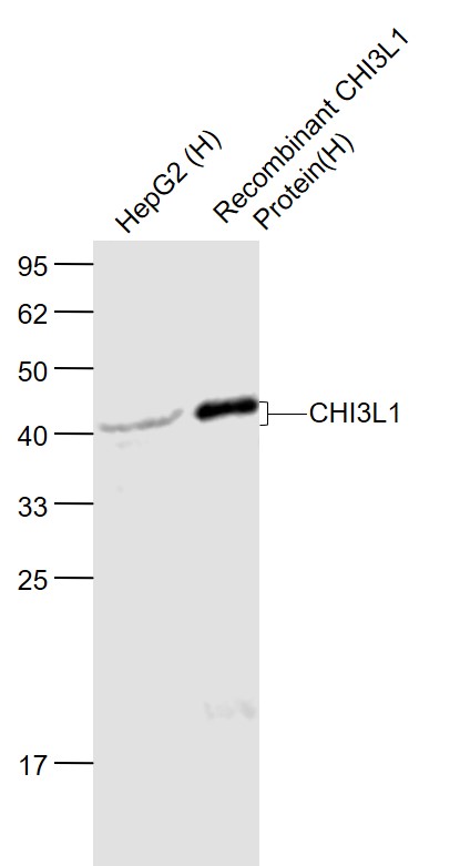 CHI3L1 Rabbit pAb(bs-10215R)-5