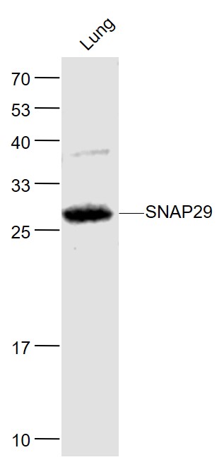 SNAP29 Rabbit pAb(bs-11363R)-5
