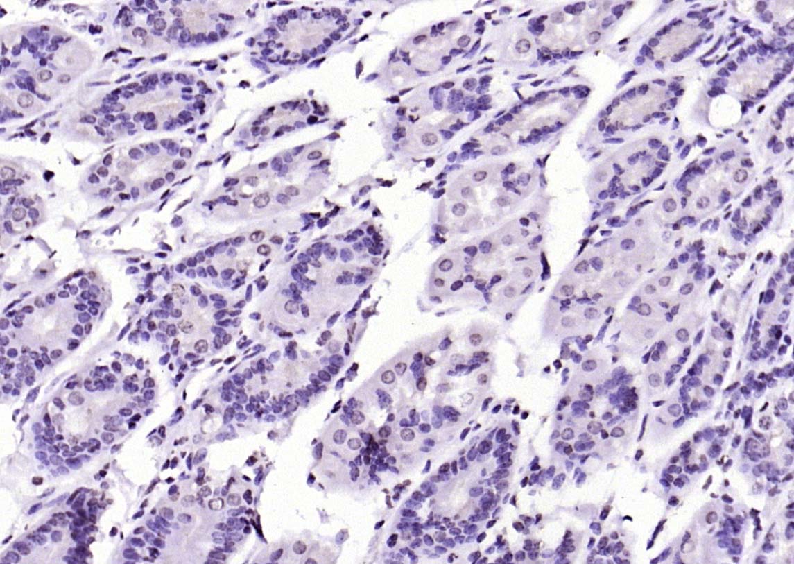 SIK1 Rabbit pAb(bs-6252R)-50ul