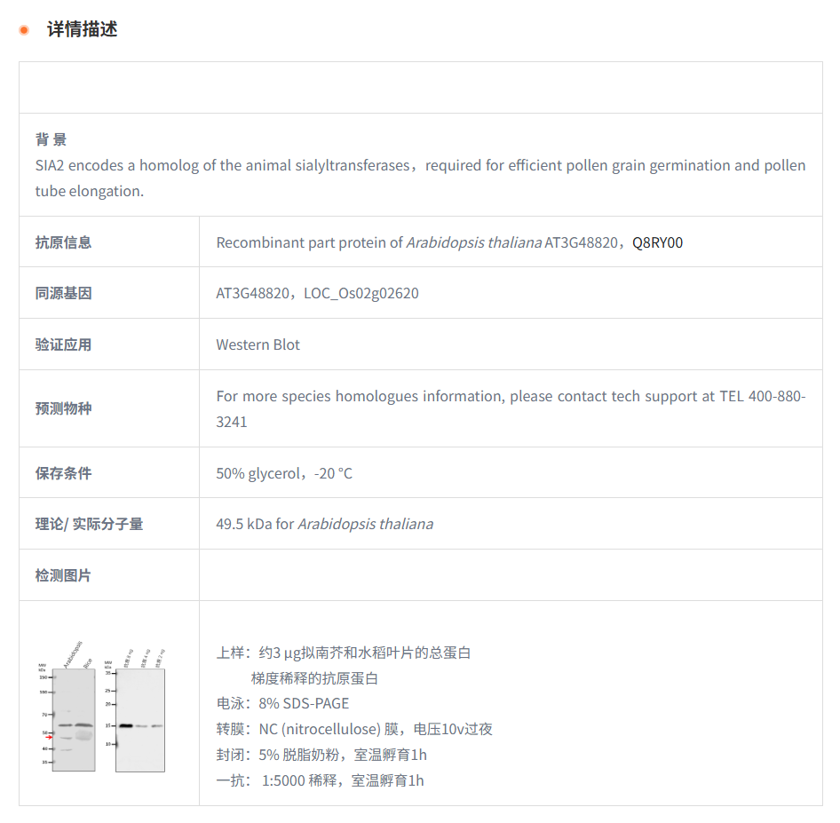 【植物抗体】Anti-SIA2/ Sialyltransfe
