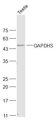 GAPDHS Rabbit pAb(bs-13282R)-5