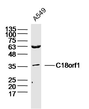 C18orf1 Rabbit pAb(bs-9652R)-5