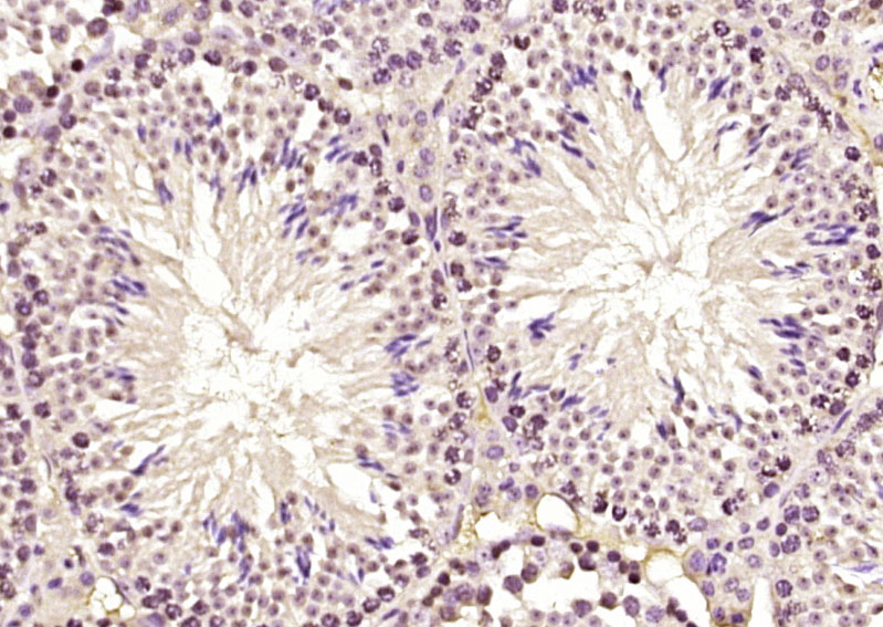 ELYS Rabbit pAb(bs-9880R)-50ul