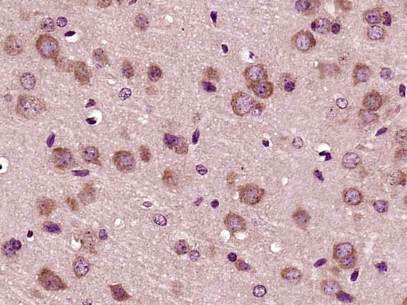 phospho-PFKFB3/PFK2 (Ser467) R