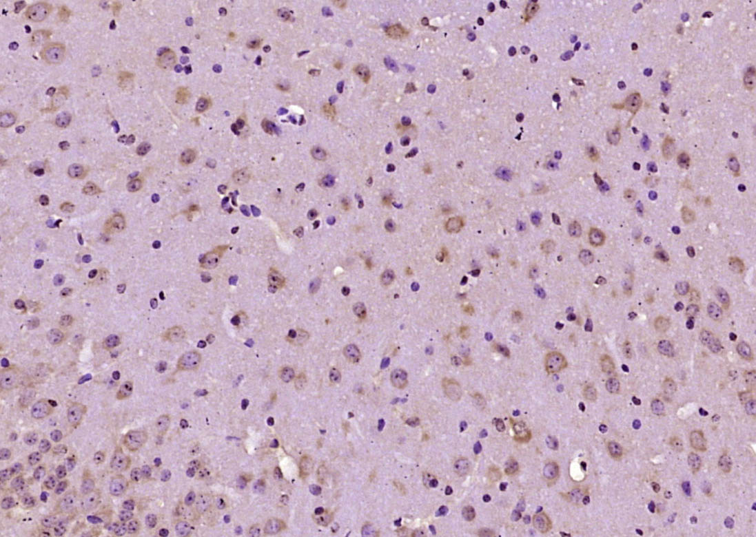 GNAS Rabbit pAb(bs-8160R)-50ul