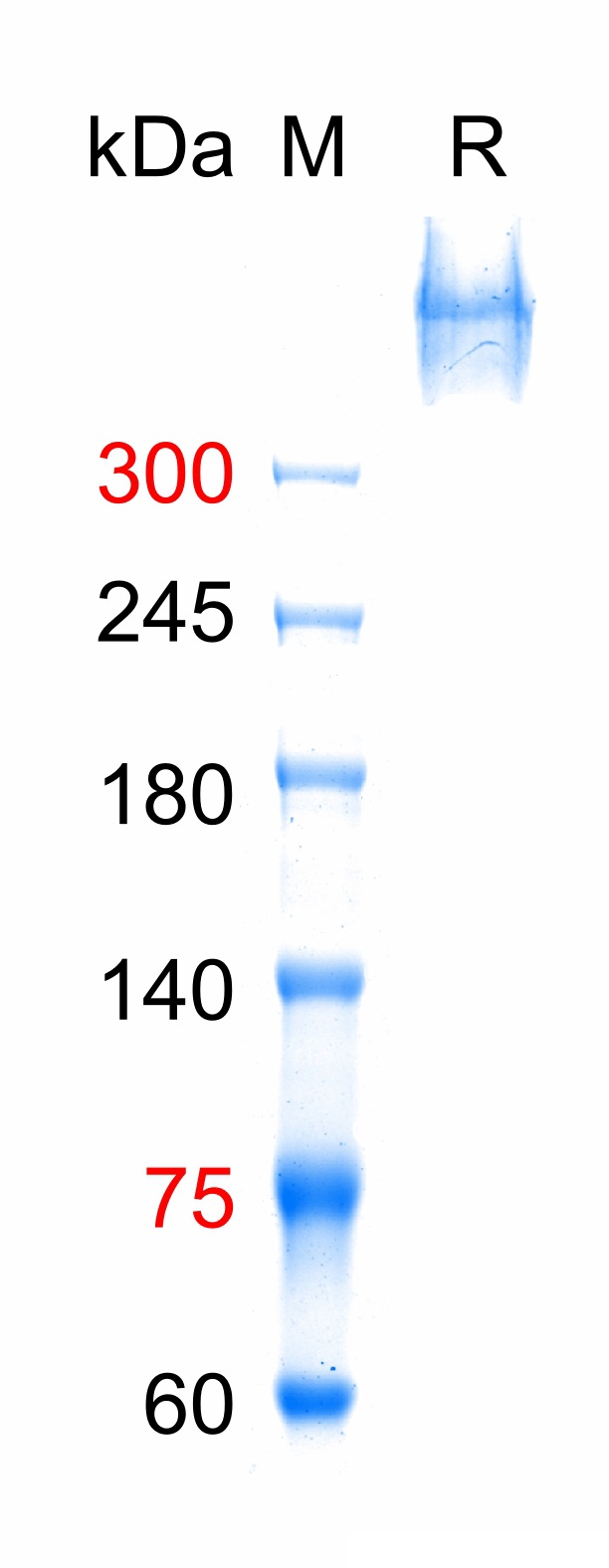 Human ox-LDL(bs-1698P)-1mg/2mg