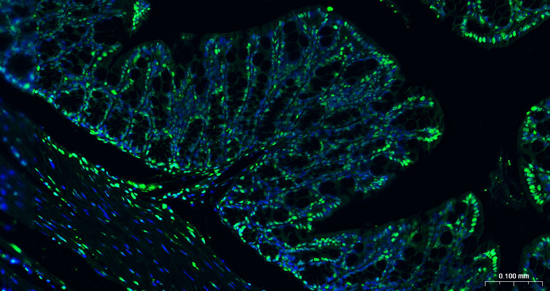 Histone H3(di methyl K27) Mous