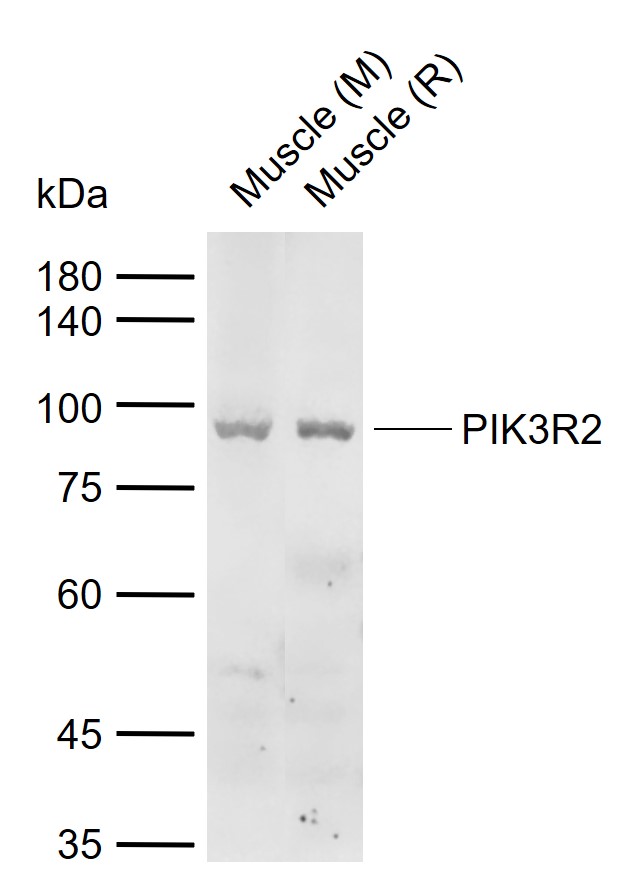 PIK3R2 Rabbit pAb(bs-4160R)-50