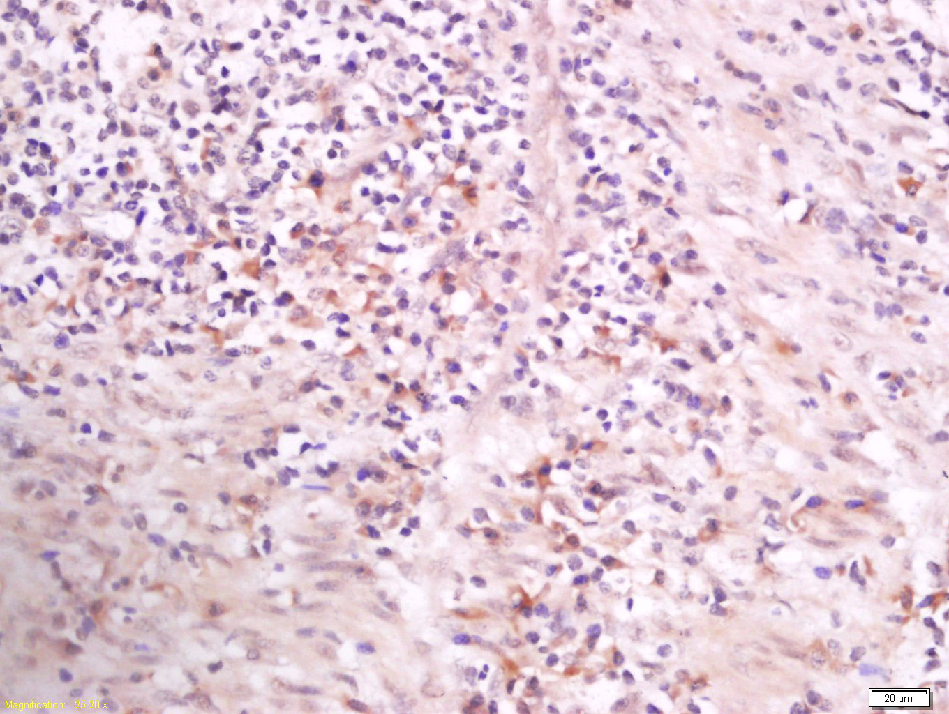 phospho-PLCG1 (Tyr783) Rabbit 