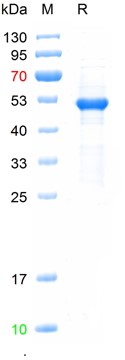 Recombinant HCoV-NL63 protein,
