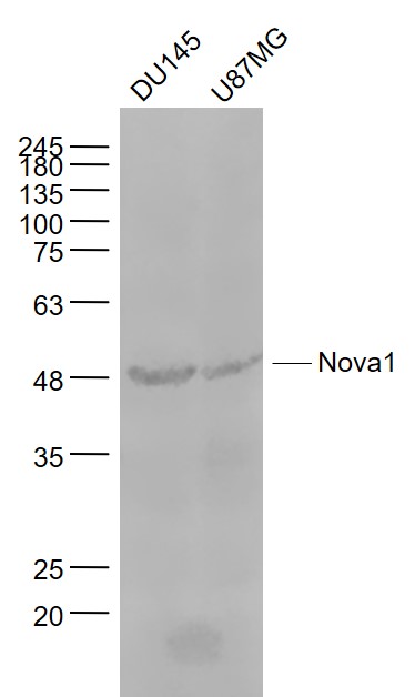 Nova1 Rabbit pAb(bs-11324R)-50