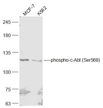 phospho-c-Abl (Ser569) Rabbit 