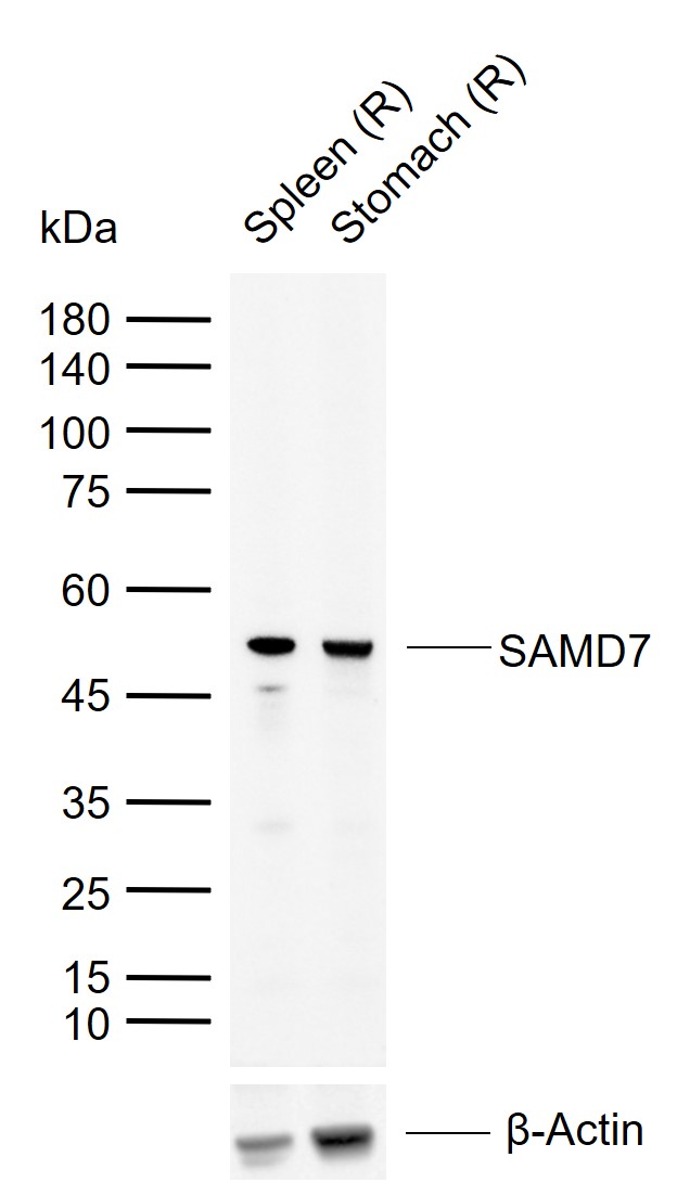 SAMD7 Rabbit pAb(bs-9003R)-50u