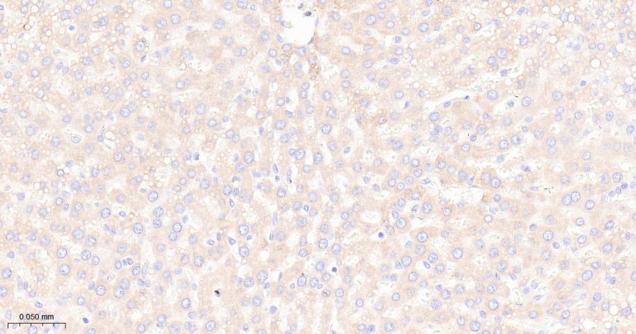 mTOR Recombinant Rabbit mAb(bs
