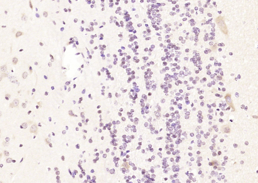 GALM Rabbit pAb(bs-13268R)-50u