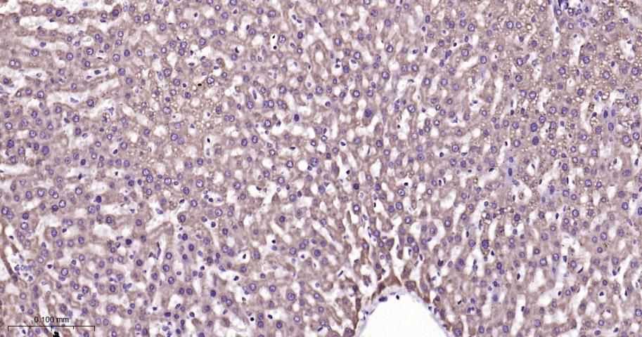 VDAC1 Recombinant Rabbit mAb, 