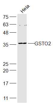 GSTO2 Rabbit pAb(bs-16344R)-50