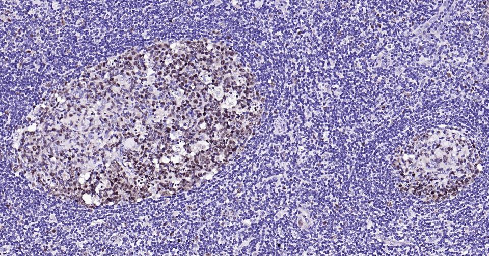 PCNA Rabbit pAb(bs-10889R)-50u