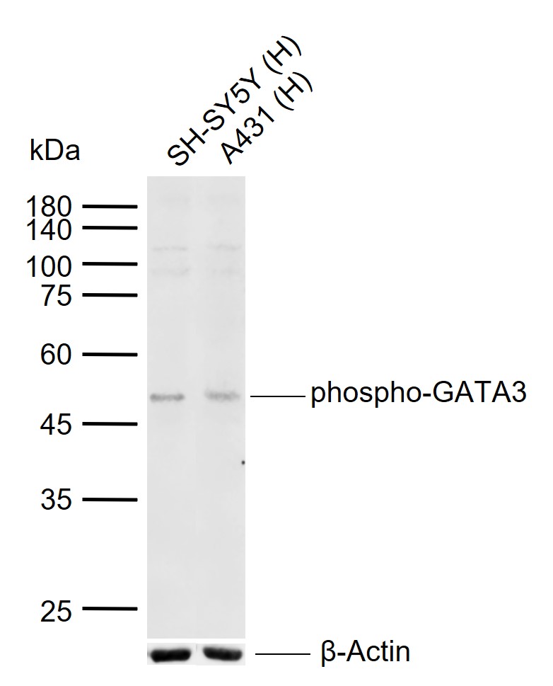 phospho-GATA3 (Ser308) Rabbit 