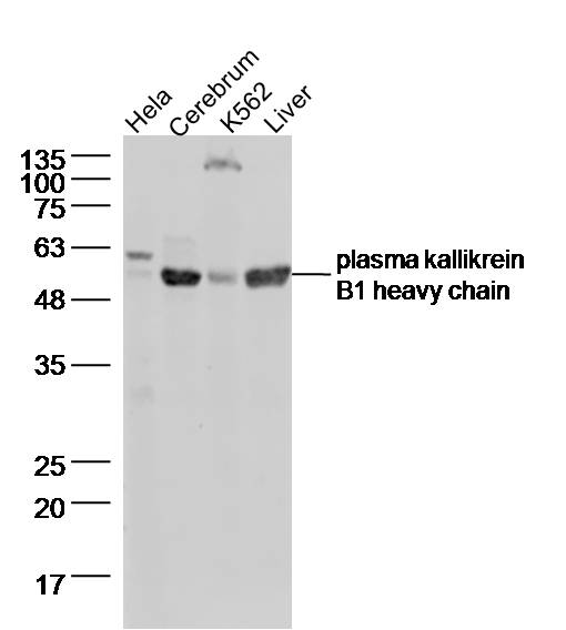 plasma kallikrein B1 heavy cha