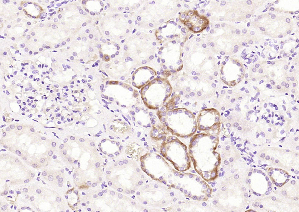 ART1 Rabbit pAb(bs-12531R)-50u