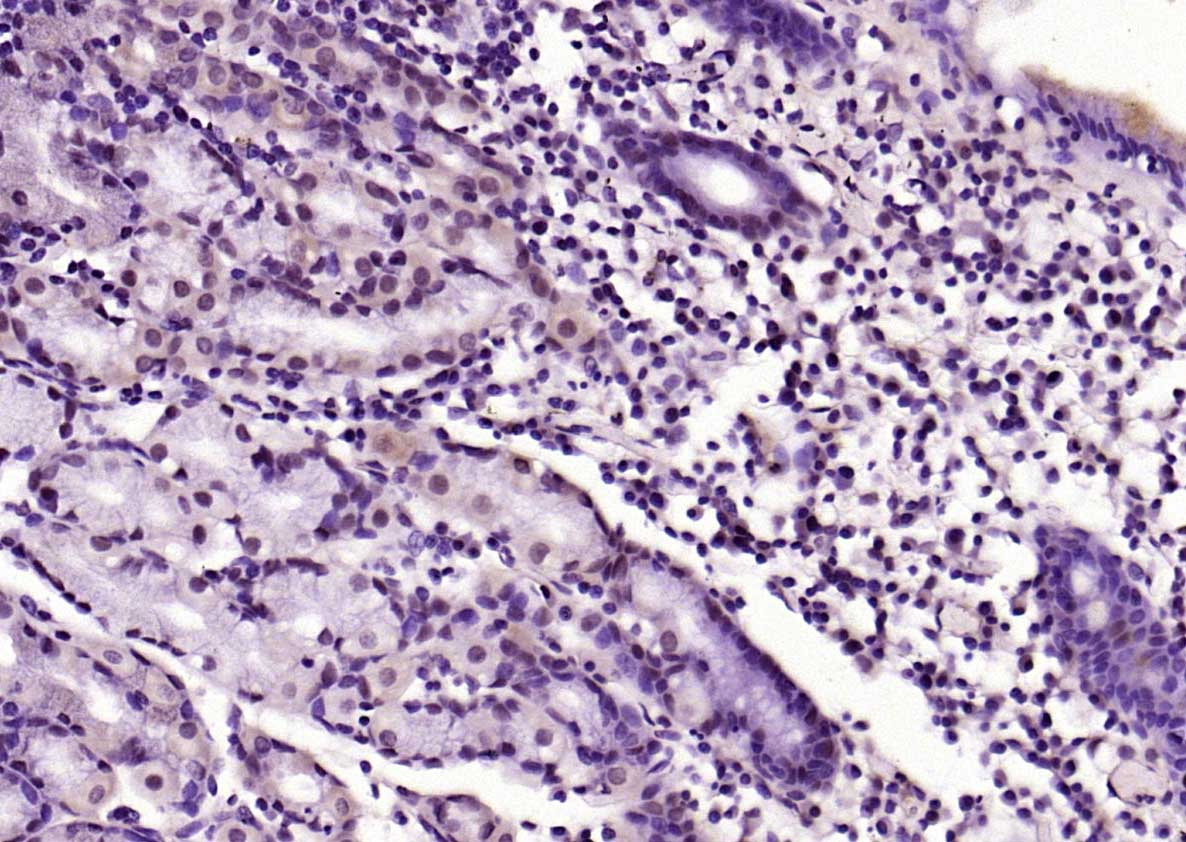 phospho-FADD (Ser194) Rabbit p