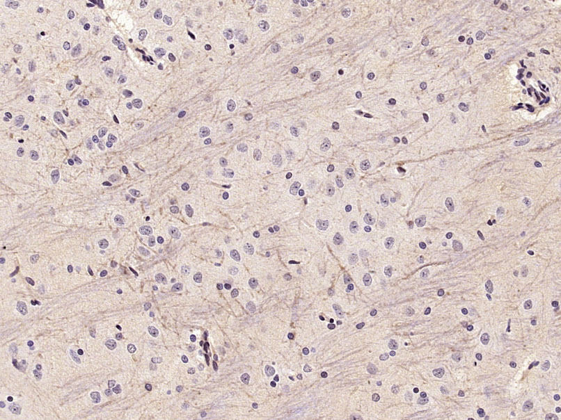 KCNMA1/BK channel Rabbit pAb(b